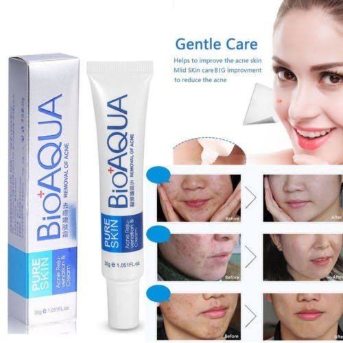 Bioaqua Acne Cream – Skin Care for Acne, Scars & Wrinkles